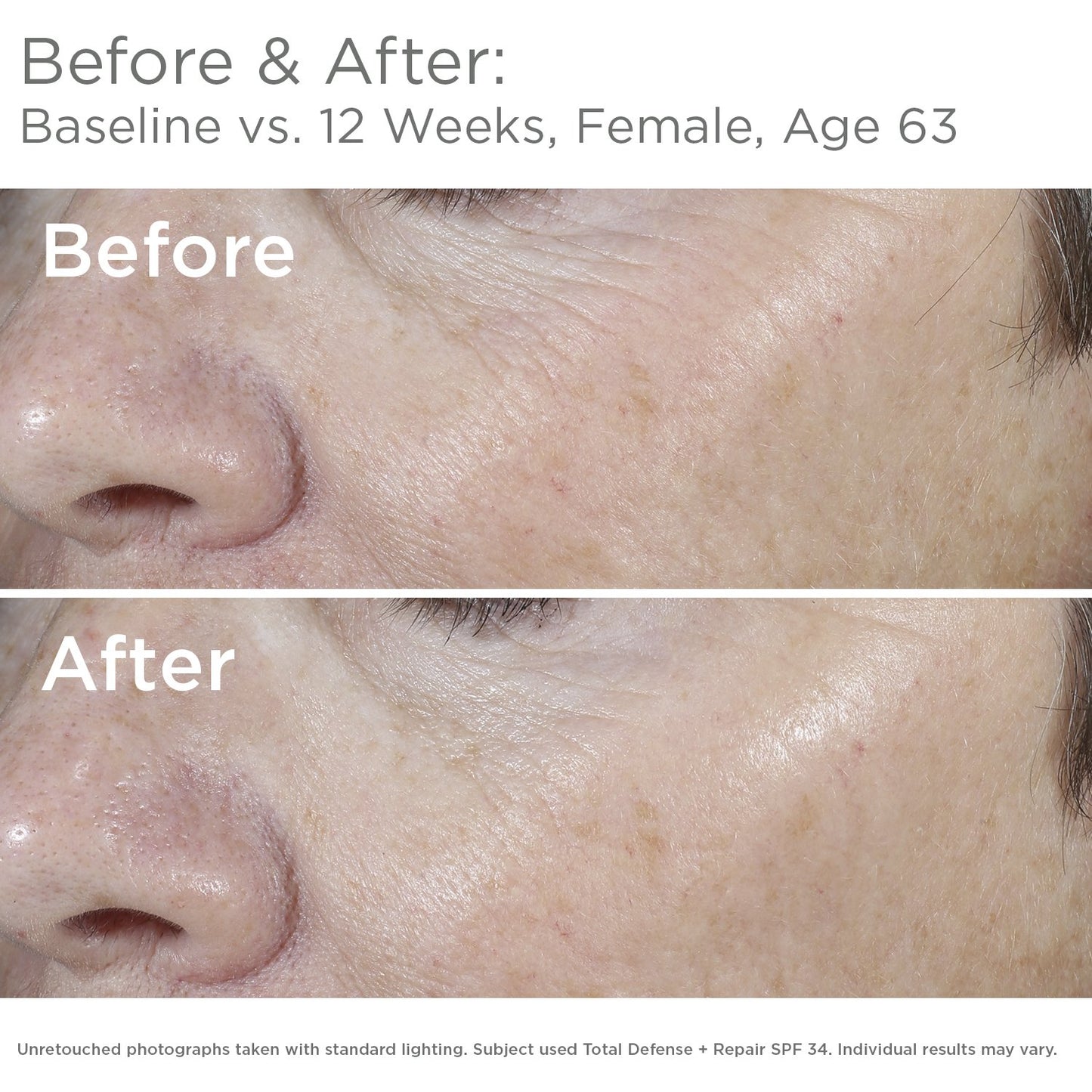 SkinMedica Total Defense + Repair SPF 34 Sunscreen - Broad Spectrum Protection for Your Face