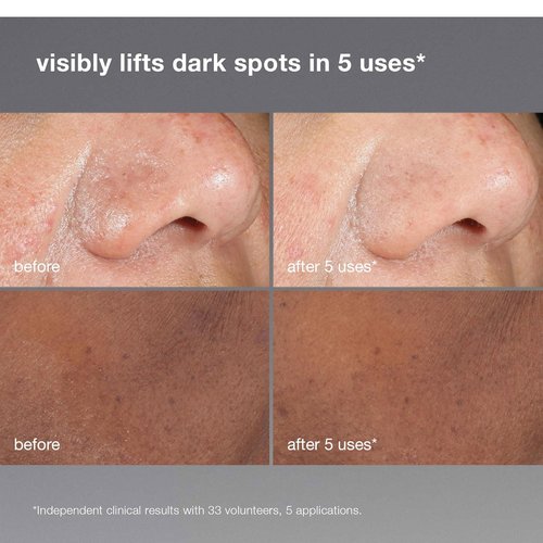 Dermalogica PowerBright Dark Spot Face Peel - Exfoliating 12% AHA & PHA Treatment for All Skin Types