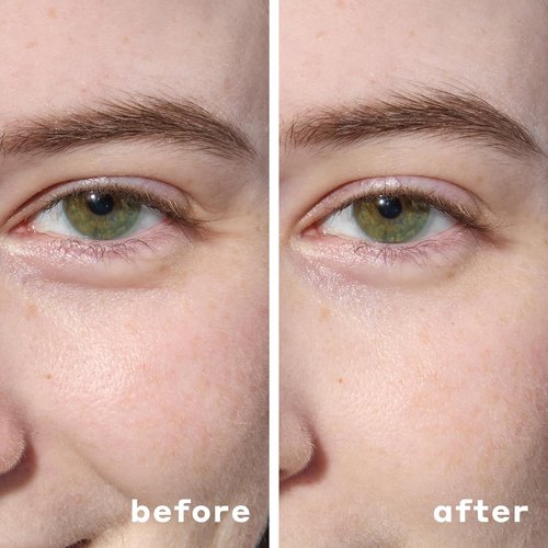 Mario Badescu Hydrogel Under Eye Patches - Hydrating Eye Masks for Dark Circles & Puffiness (30 Pairs)