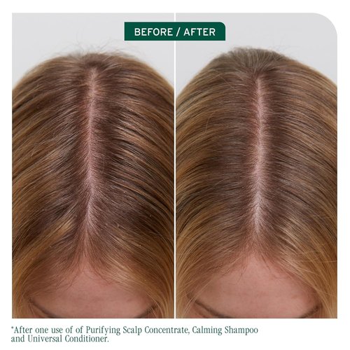 Biolage Scalp Sync Calming Shampoo - Hydrating Formula for Dry, Sensitive Scalps | Vegan & Paraben-Free