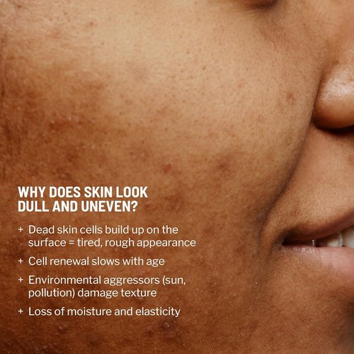 Dr. Brandt Advanced Microdermabrasion Face Exfoliator - Refines Texture & Minimizes Fine Lines - 2 oz