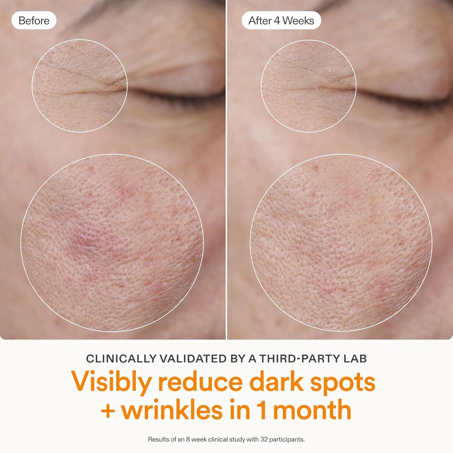 Skinfix Brighten + Firm Vitamin C Serum - 15% Concentration for Dark Spots & Fine Lines - Safe for Sensitive Skin