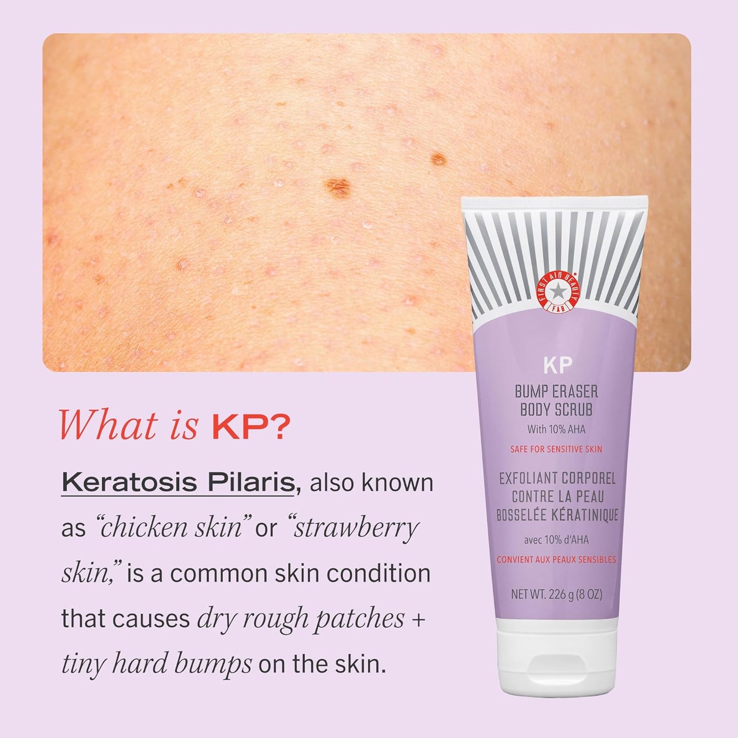 First Aid Beauty KP Bump Eraser Body Scrub Exfoliant for Keratosis Pilaris with 10% AHA – 8 oz