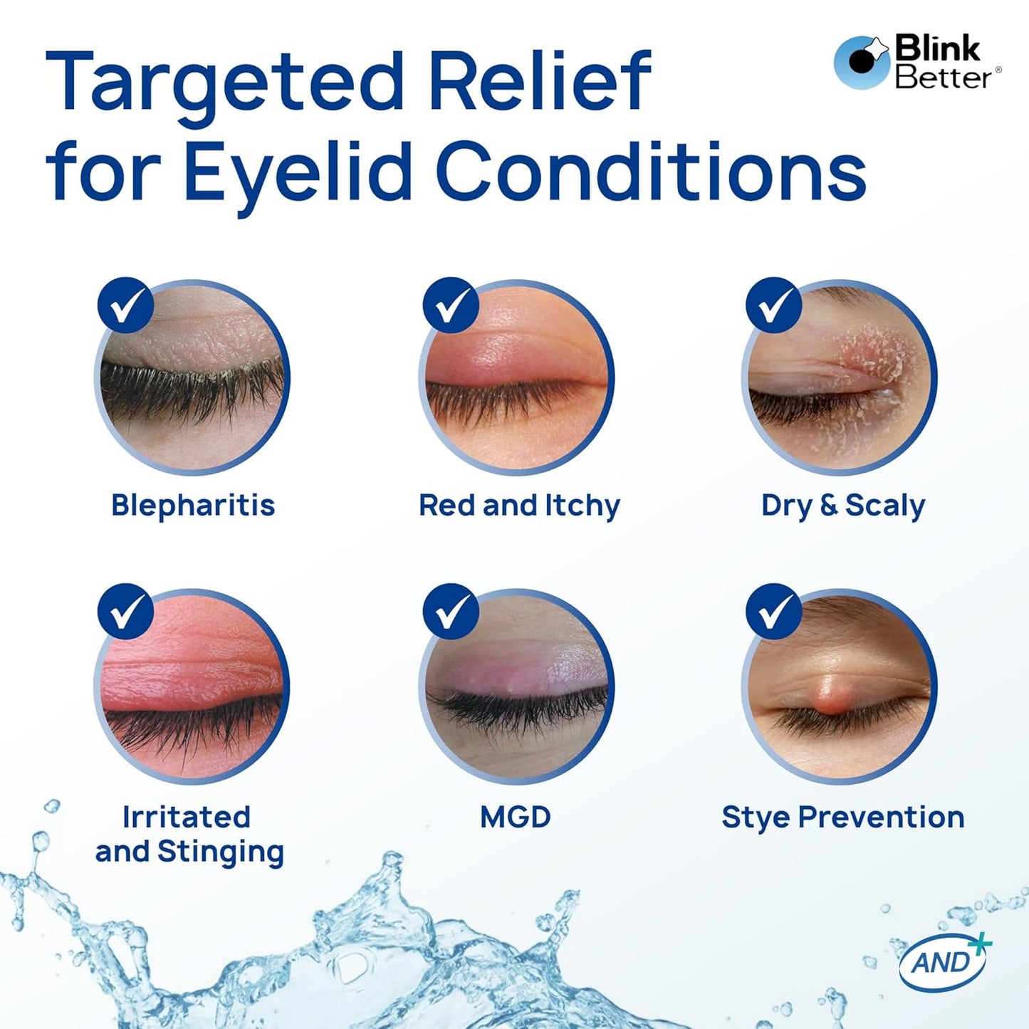 BlinkBetter BetterLids Hypochlorous Acid Eyelid Spray - Gentle Non-Sting Cleanser for Dry, Itchy Lids | 50 ml