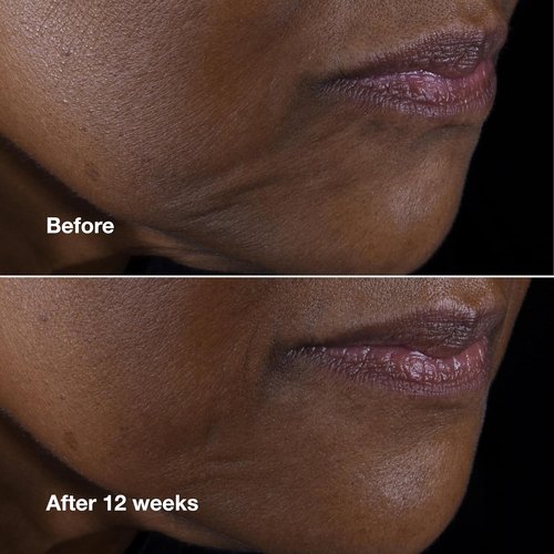 Clinique Smart Clinical Repair Anti-Aging Face & Neck Cream - Hydrating Peptides & Hyaluronic Acid for All Skin Types