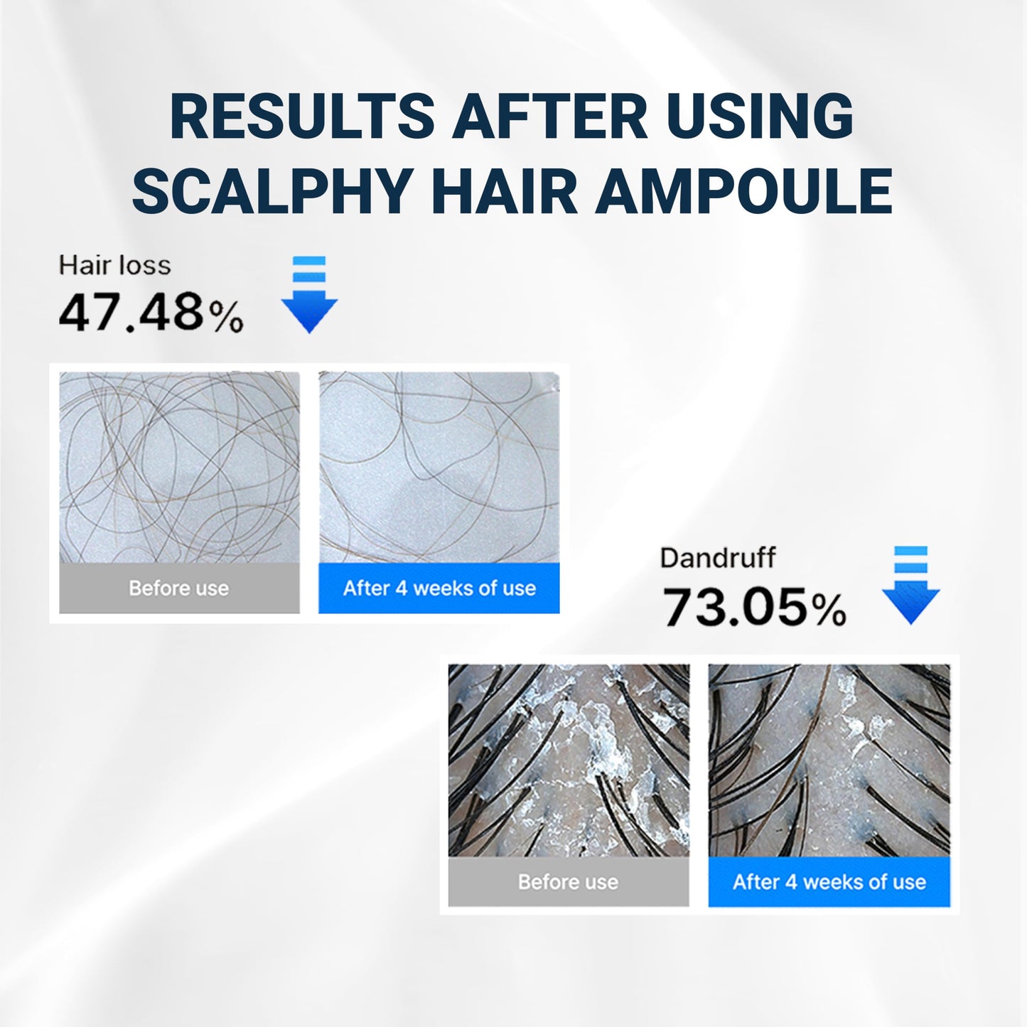 Seapuri Scalphy Viral Hair Growth Treatment Topical Serum for Hair Loss, Thinning, Receding Hairline | Cooling Rollerball Scalp Massager for Men and Women | Hair Regrowth | Korean Beauty 0.67 Fl Oz