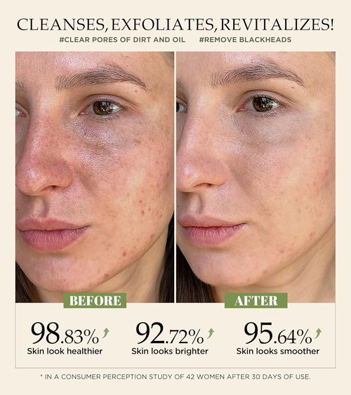 Revitalizing Exfoliation Face Scrub by [Brand Name] - Vitamin C & Turmeric for Blackheads & Dark Spots | 4.23 Fl Oz