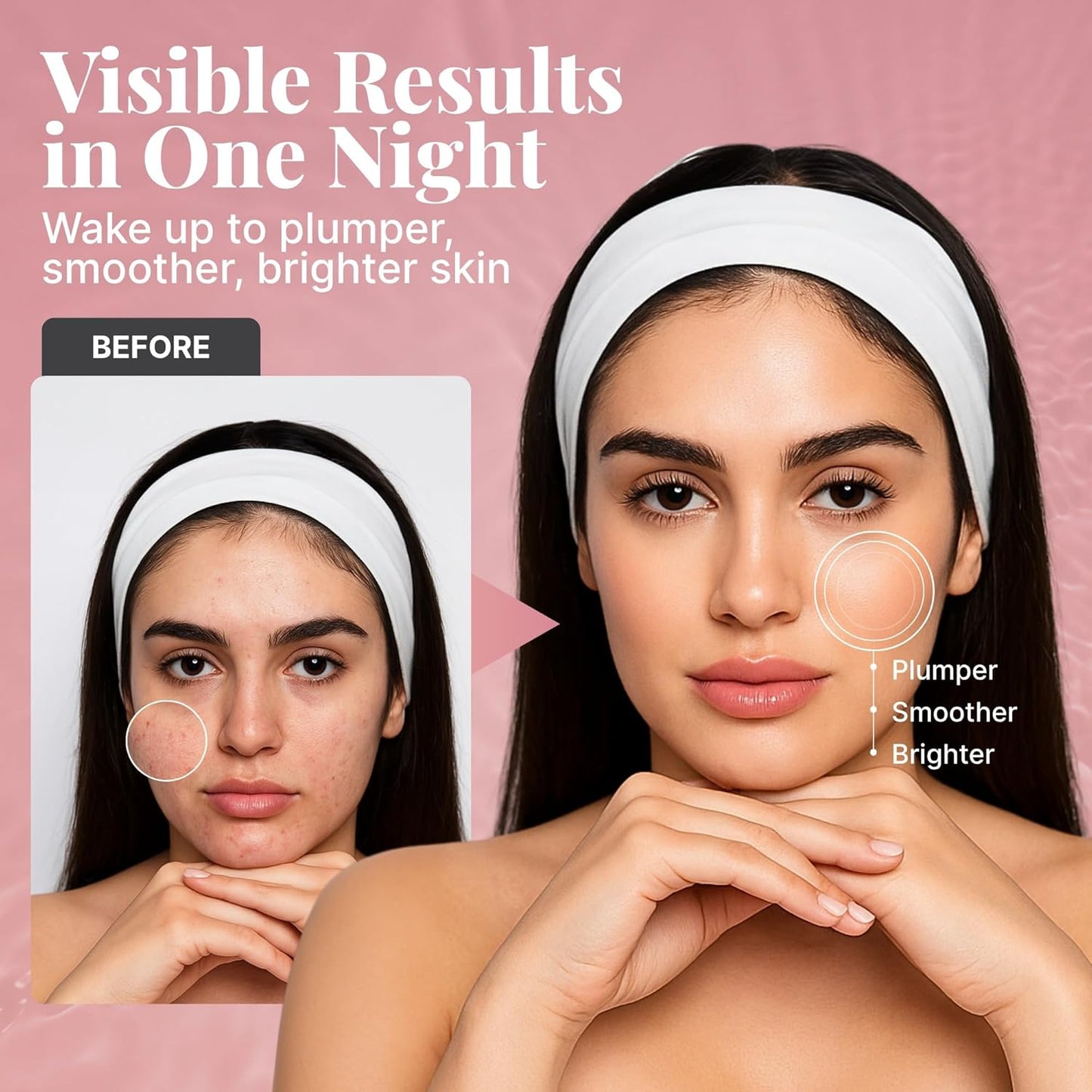 Bio Collagen Face Mask - Overnight Hydrating Hydrogel Masks | 6 Pack for All Skin Types, Anti-Aging & Moisturizing