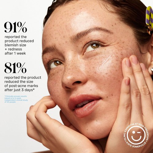 Kate Somerville EradiKate Acne Mark Fading Gel - Salicylic Acid Acne Treatment - Visibly Reduces Acne Scars, Clears Skin & Prevents Breakouts, 1 Fl Oz