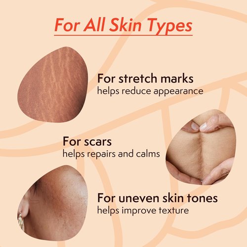 Nature Spell Stretch Mark Oil - Vegan Body Oil for Scars & Uneven Skin Tone | 3.38 Fl Oz