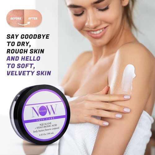 NOW Beauty Squalane Body Butter - Hydrating Coconut Oil & Shea Butter Lotion for Dry Skin - 6 oz