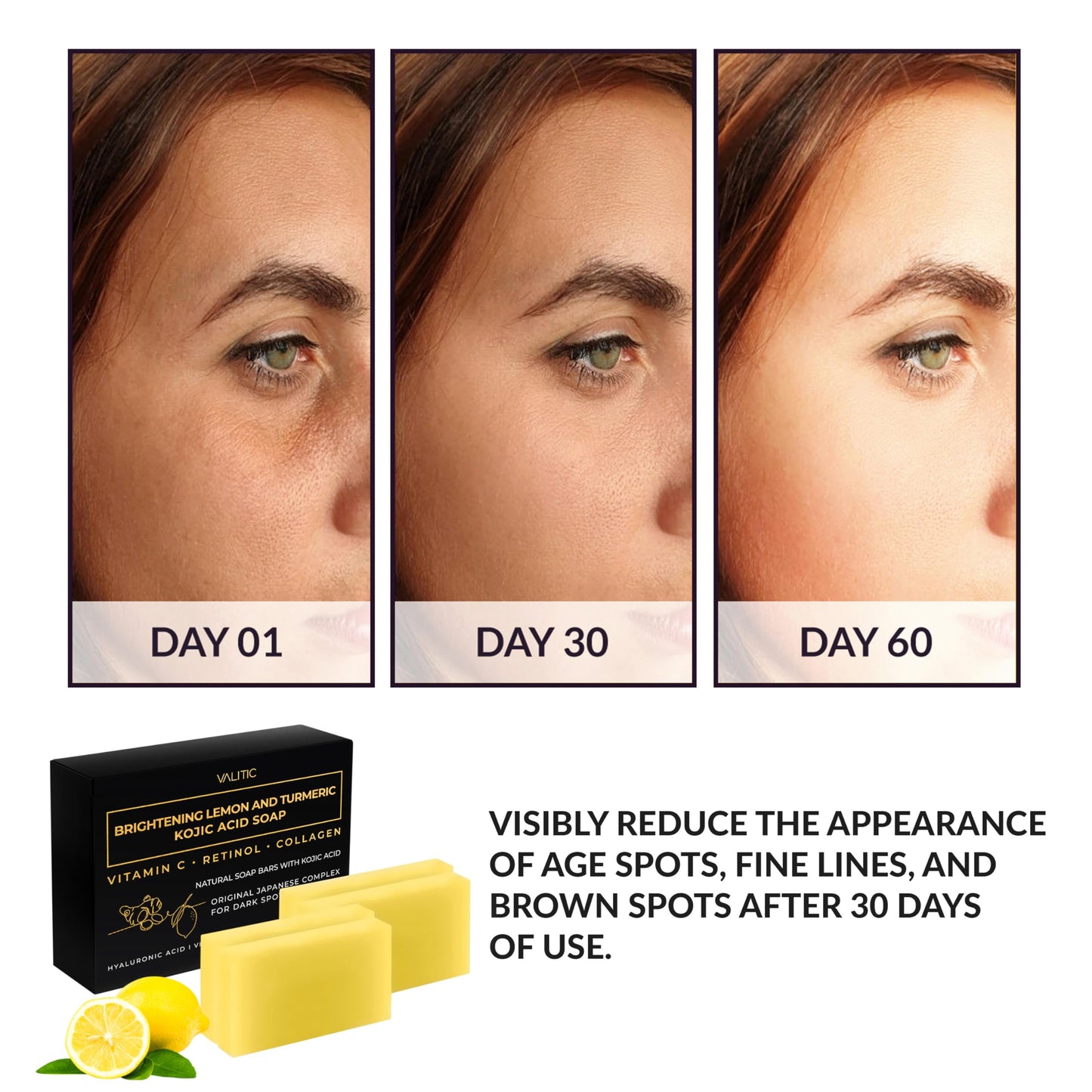 VALITIC Brightening Lemon & Turmeric Kojic Acid Soap with Vitamin C, Retinol, Collagen - Original Japanese Complex Infused with Hyaluronic Acid, Vitamin E, Shea Butter, Castile Olive Oil (4 Pack)