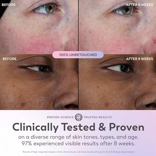 Olay Super Serum - Glow Face Serum with Niacinamide, Vitamin C & E - 5-in-1 Anti-Aging Benefits - 1.0 Oz