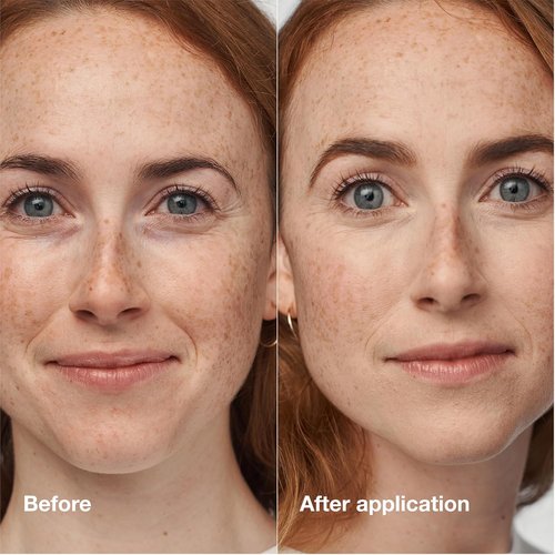 Clinique Even Better Clinical Serum Foundation - Full Coverage Hydrating SPF 25 with Vitamin C & Hyaluronic Acid for Oily Skin