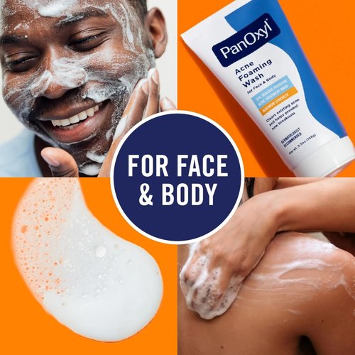 PanOxyl Foaming Acne Wash - Maximum Strength Formula | 5.5 oz (Pack of 6) for Clear Skin