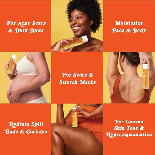 Bio-Oil Natural Skincare Oil - Serum for Scars & Stretch Marks | 4.2 Oz Moisturizer for All Skin Types