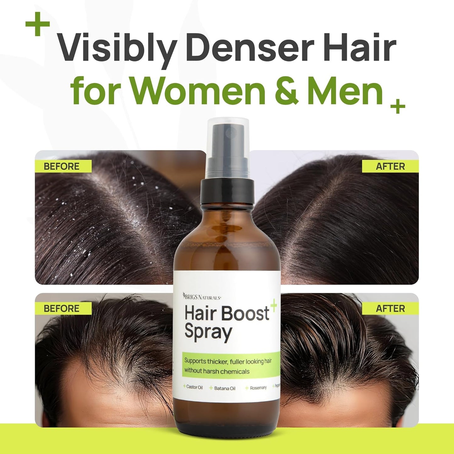 Skiennix Hair Boost Spray - Thicker, Healthier Hair with Organic Botanicals | 8 oz