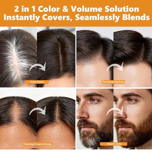 Root Touch Up Hair Color Spray - 4oz | Instant Gray Coverage, Sweat-Resistant, Medium Brown for All