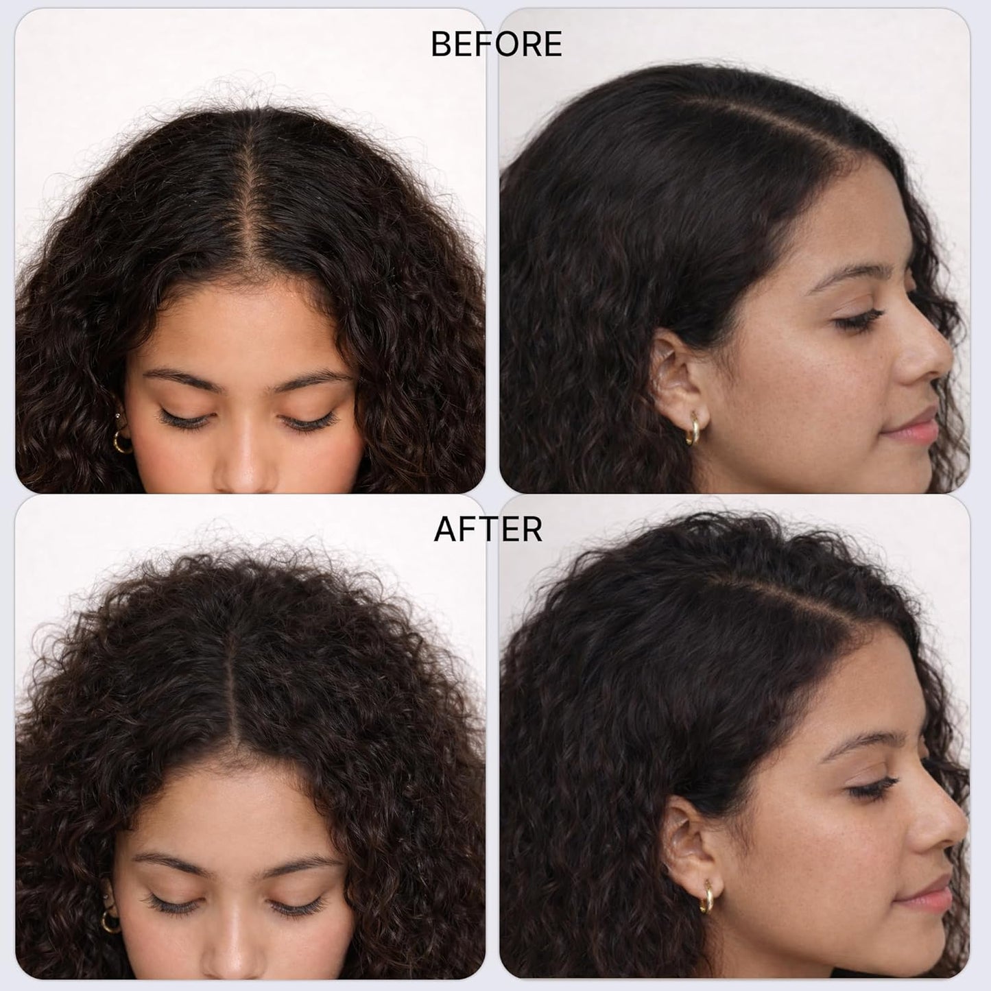 Skiennix Hair Thickening Serum - Reduces Hair Loss & Promotes Growth | 1 Fl Oz (Pack of 2)