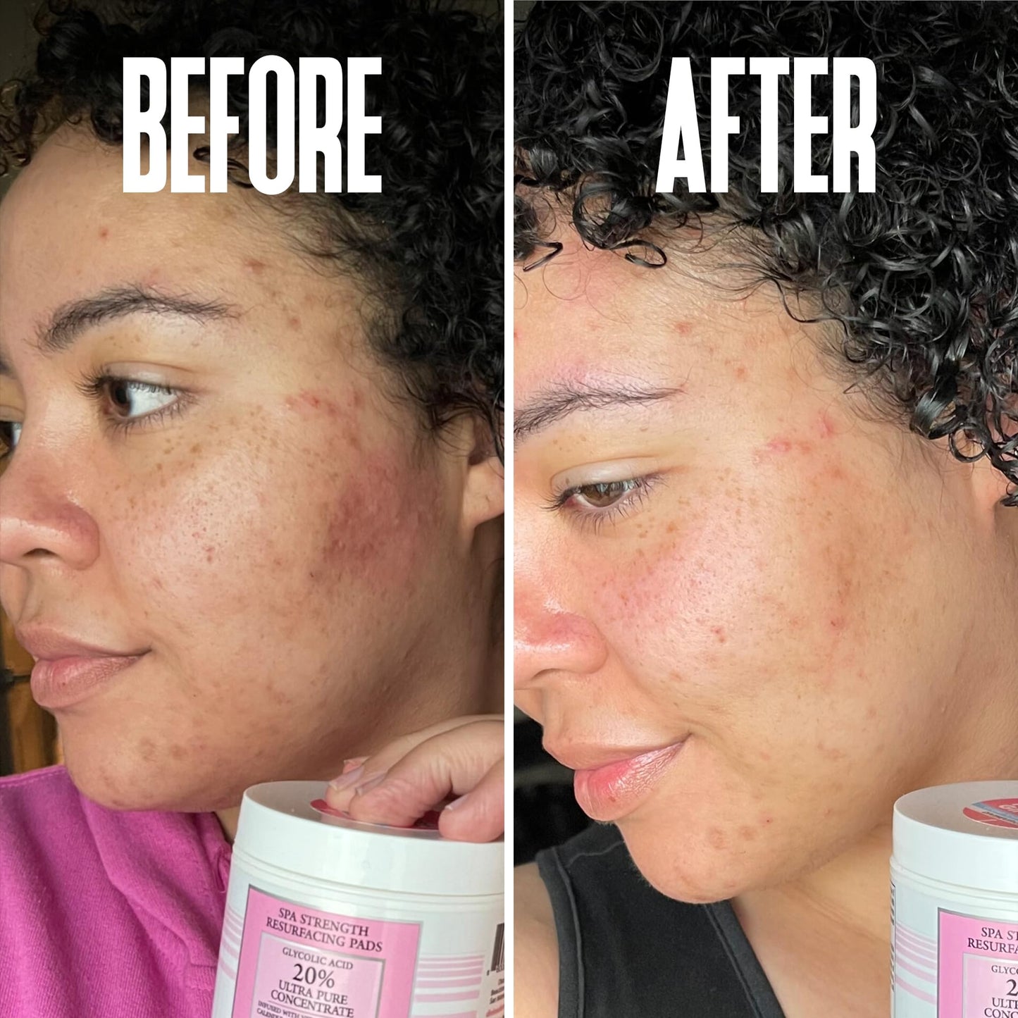 Glycolic Acid Pads with Vitamin C - Toner Pads for Face Cleansing With Tea Tree Oil - Exfoliating Pads with 20% AHA & Vitamins E, B3, B5 - Facial Peel Resurfacing Pads, Glycolic Acid Peel (50)