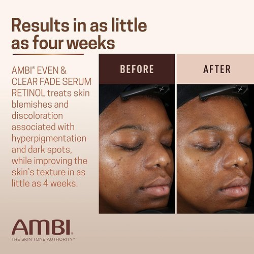 Ambi Even & Clear Fade Serum - Hydroquinone-Free Dark Spot Corrector with Retinol & Niacinamide | 1 Fl Oz