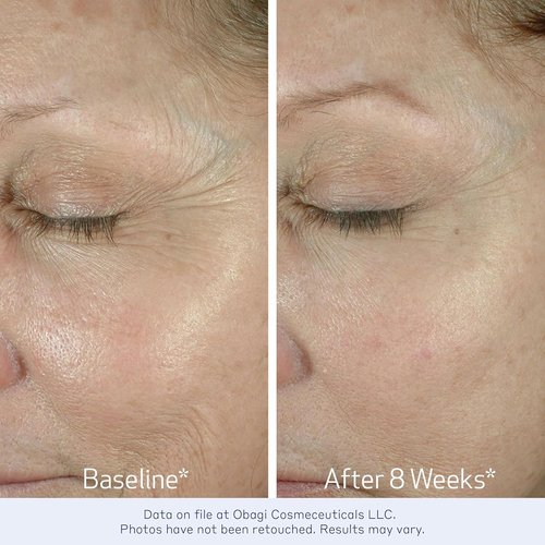 Obagi ELASTIderm Eye Cream - Lightweight Formula Proven to Reduce Fine Lines & Wrinkles