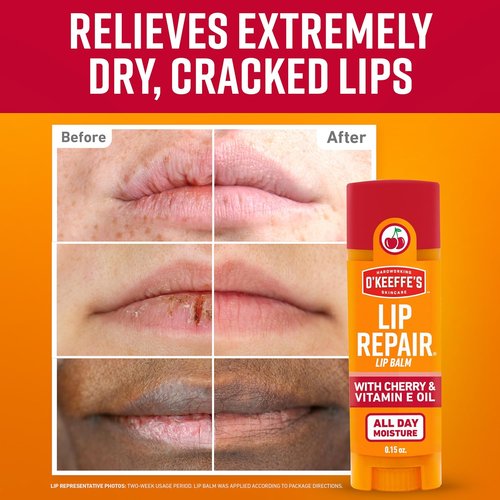 O'Keeffe's Lip Repair Balm - Cherry & Vitamin E Oil - 3 Pack for Extremely Cracked, Dry Lips