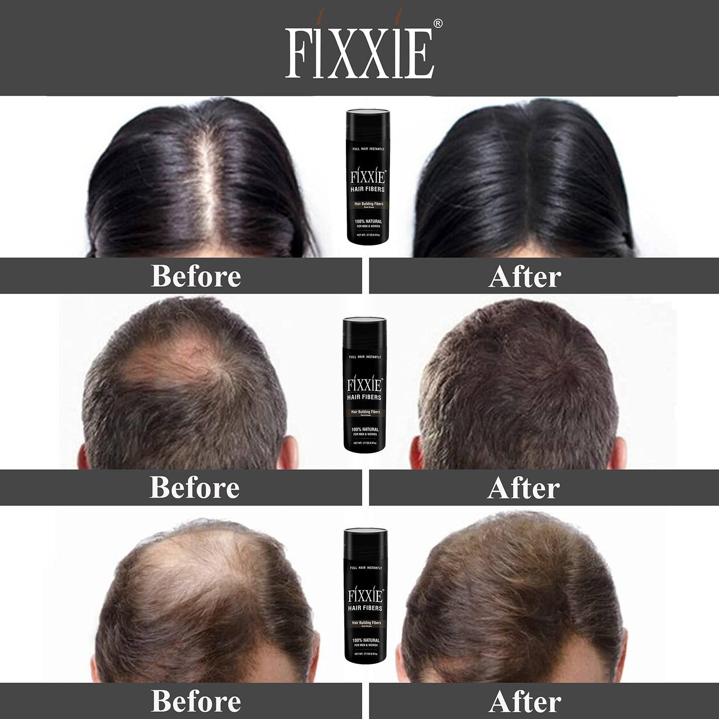 FIXXIE Hair Fibers DARK BLONDE for Thinning Hair 27.5g Bottle, Hair Fibre Concealer for Hair Loss for Men and Women, Naturally Thicker Looking Hair with Keratin Hair Fibres