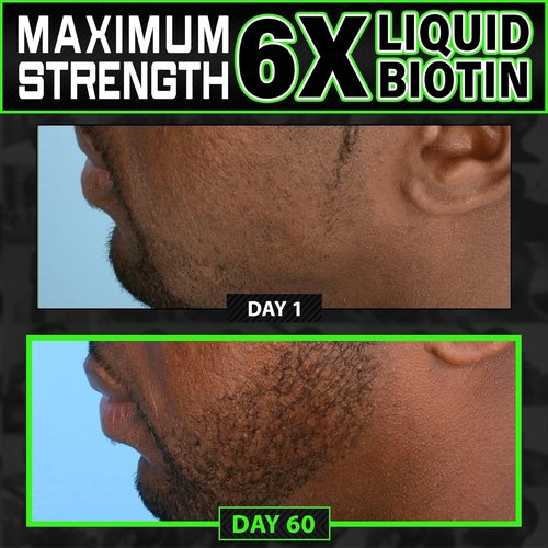Regine Switzerland Beard Growth Kit - 2X Thickening Biotin Balm & Conditioner + 6X Liquid Biotin with Collagen Peptides for Enhanced Beard & Hair Growth