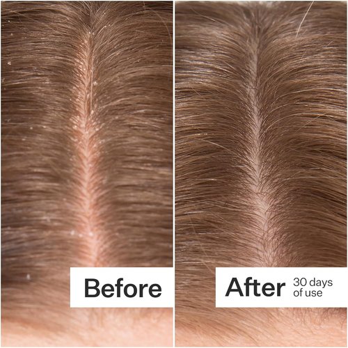 ACT+ ACRE Microbiome Cooling Scalp Serum - Instant Relief for Dry, Itchy Scalps - 2.2 fl oz