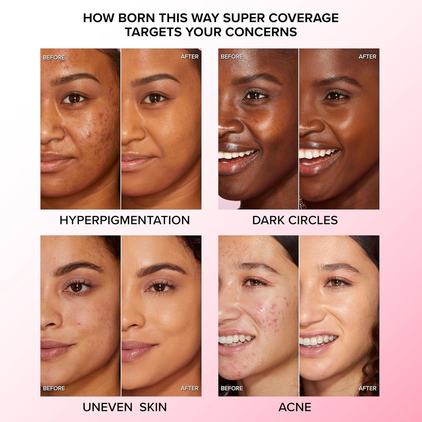 Too Faced Born This Way Concealer - Full Coverage, Non-Comedogenic, Oil-Free | Infused with Hyaluronic Acid, Coconut Water & Alpine Rose