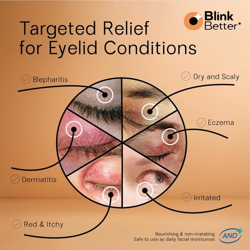 BlinkBetter BetterLids Eyelid Cream - Hydrate & Soothe Dry, Itchy Eyelids | Lightweight Formula with 3% Oat & Ceramides, 1 fl oz