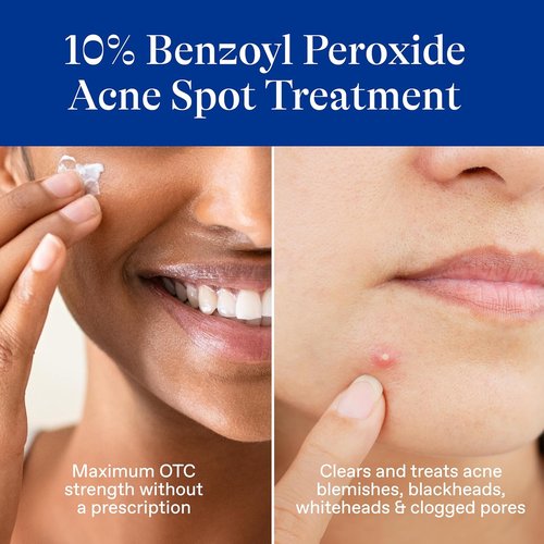 Differin Acne Spot Treatment - Maximum Strength 10% Benzoyl Peroxide | Fast-Acting 1 oz Solution