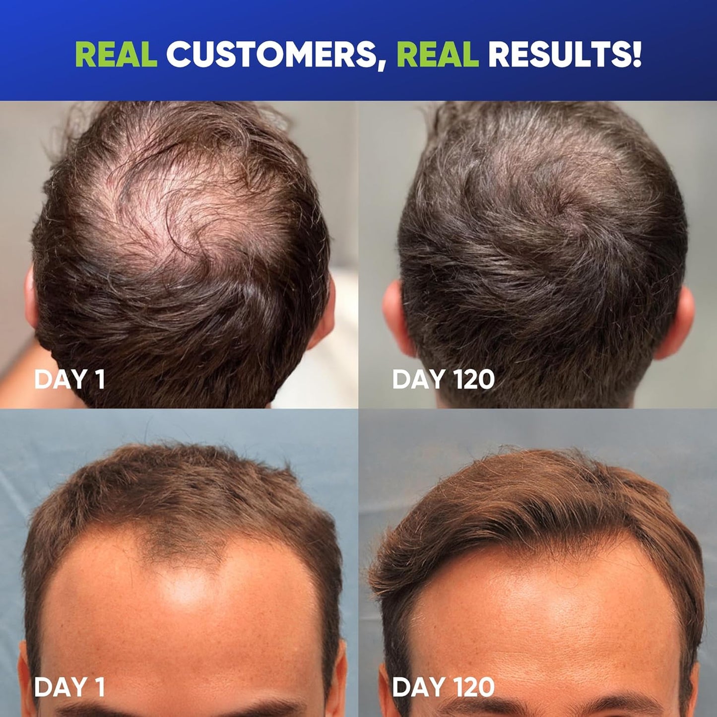 Svvimer Hair Growth Shampoo for Men - Biotin & Rosemary Formula for Thinning Hair - 13.5 Fl Oz