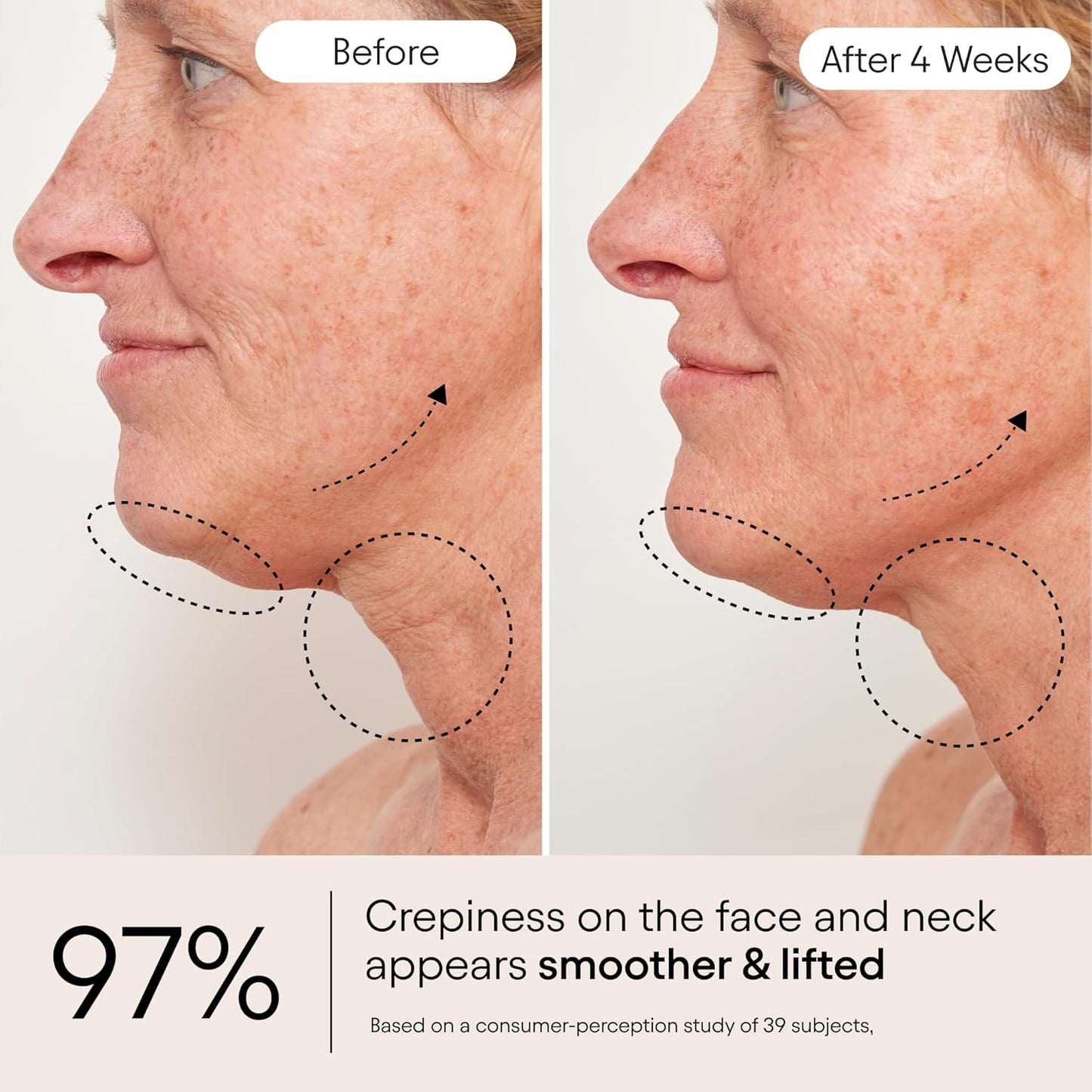 ALPYN Super Sculpt Serum - Peptide Firming & Lifting Serum for Face, Neck & Décolleté | 1.7 oz