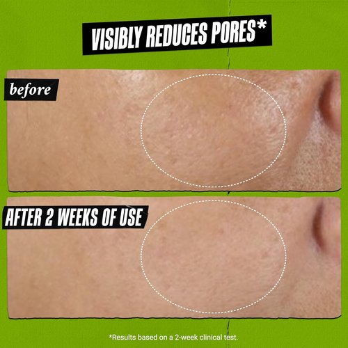 Kiehl's Rare Earth Deep Pore Cleansing Face Mask - Detoxifying Clay Formula for Blackhead & Acne Control
