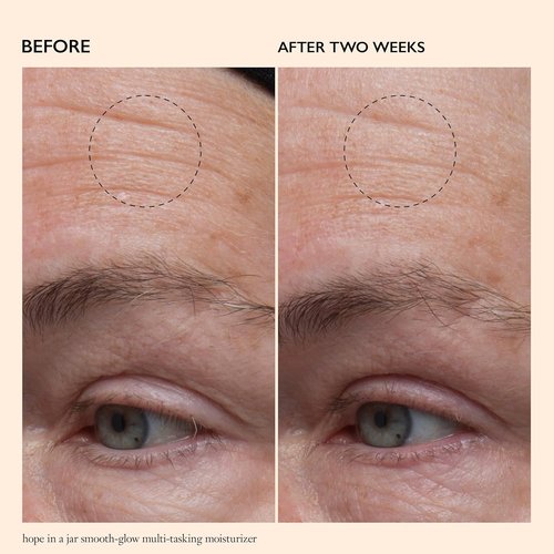 Philosophy Hope In A Jar Multi-Tasking Face Moisturizer With SPF 30 - Hydrating Formula With Pro-Vitamin P & Glycolic Acid - 2 Fl Oz