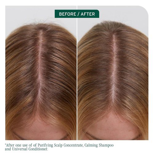 Biolage Scalp Sync Universal Conditioner - Nourishing Hydration for All Scalp Types | Lightweight Vegan Formula with Fermented Tea & Glycolic Acid