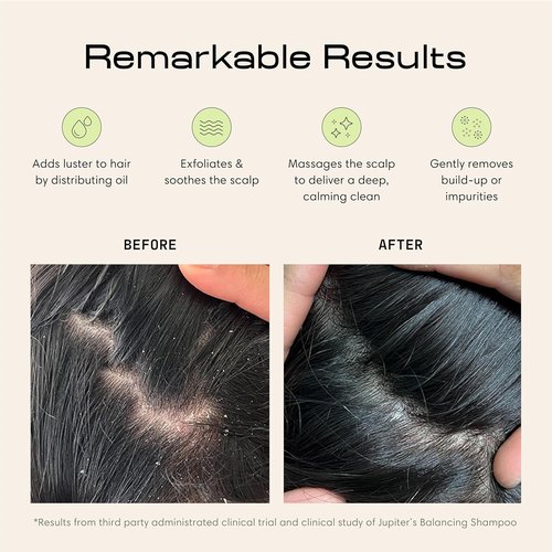 Jupiter Scalp Exfoliator - Ergonomic Scalp Massager & Dandruff Comb - Black/White Design