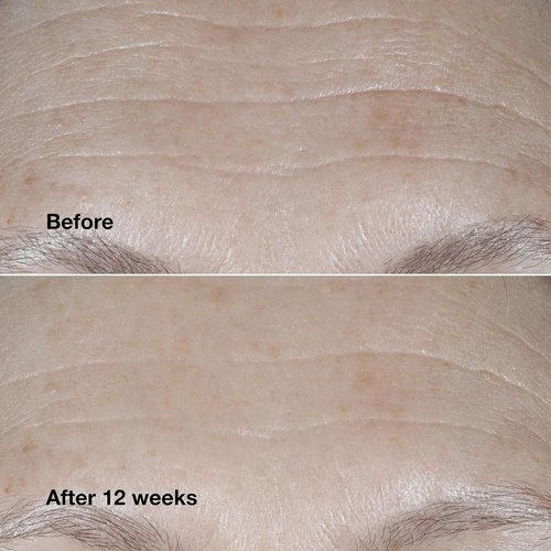 Clinique Smart Clinical Repair Cream - SPF 30 Wrinkle Correction with Peptides & Hyaluronic Acid | Protect & Repair