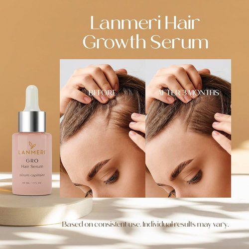 Lanmeri Vegan Hair Growth Serum - Natural Scalp Treatment for Thinning Hair | Fuller, Thicker Hair in 90 Days