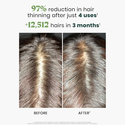 Rene Furterer Triphasic Concentrated Serum for Thinning Hair - Drug-Free & Breastfeeding Safe - 12 Ct.