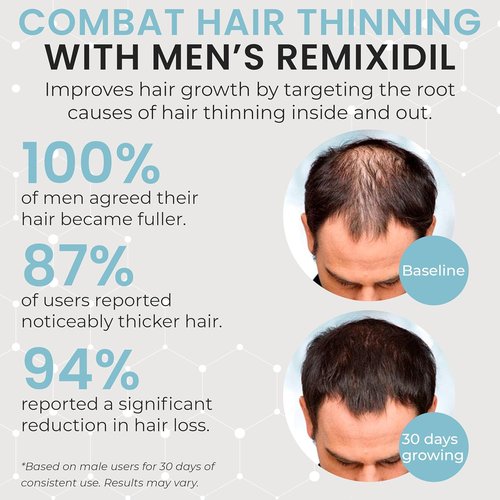 Hair Growth Vitamins - Regrow Hair & Beard | Strengthen Scalp & Reduce Thinning | Fast-Acting 60 Capsules