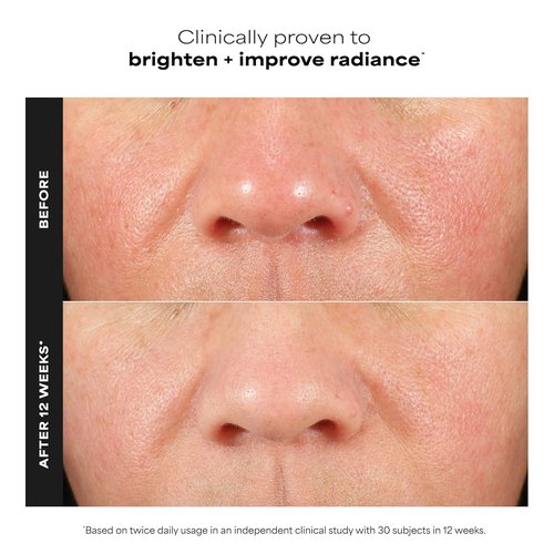 Paula's Choice BOOST C15 Super Booster - 15% Vitamin C Face Serum with Vitamin E & Ferulic Acid | Fragrance-Free