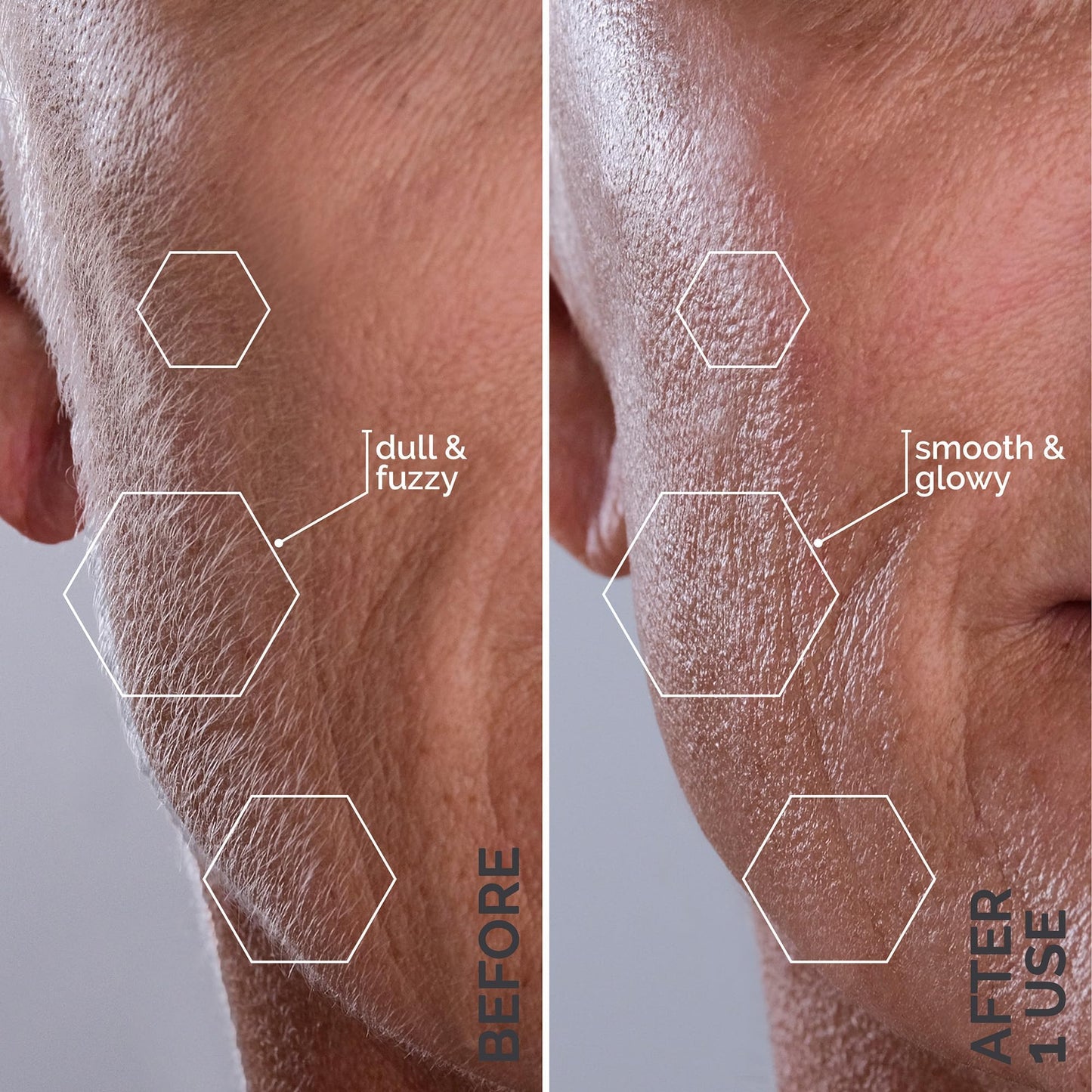 Michael Todd Beauty - Sonicsmooth - Dermaplane Razor for Women Face - SONIC Technology Dermaplaning Tool - 2 in 1 Women’s Facial Exfoliation & Peach Fuzz Hair Removal System- 8 Weeks of Safety Edges