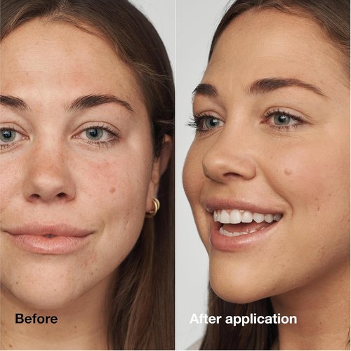 Clinique Even Better Clinical Serum Foundation - Full Coverage Hydration SPF 25 | Oily Skin, Vitamin C & Hyaluronic Acid