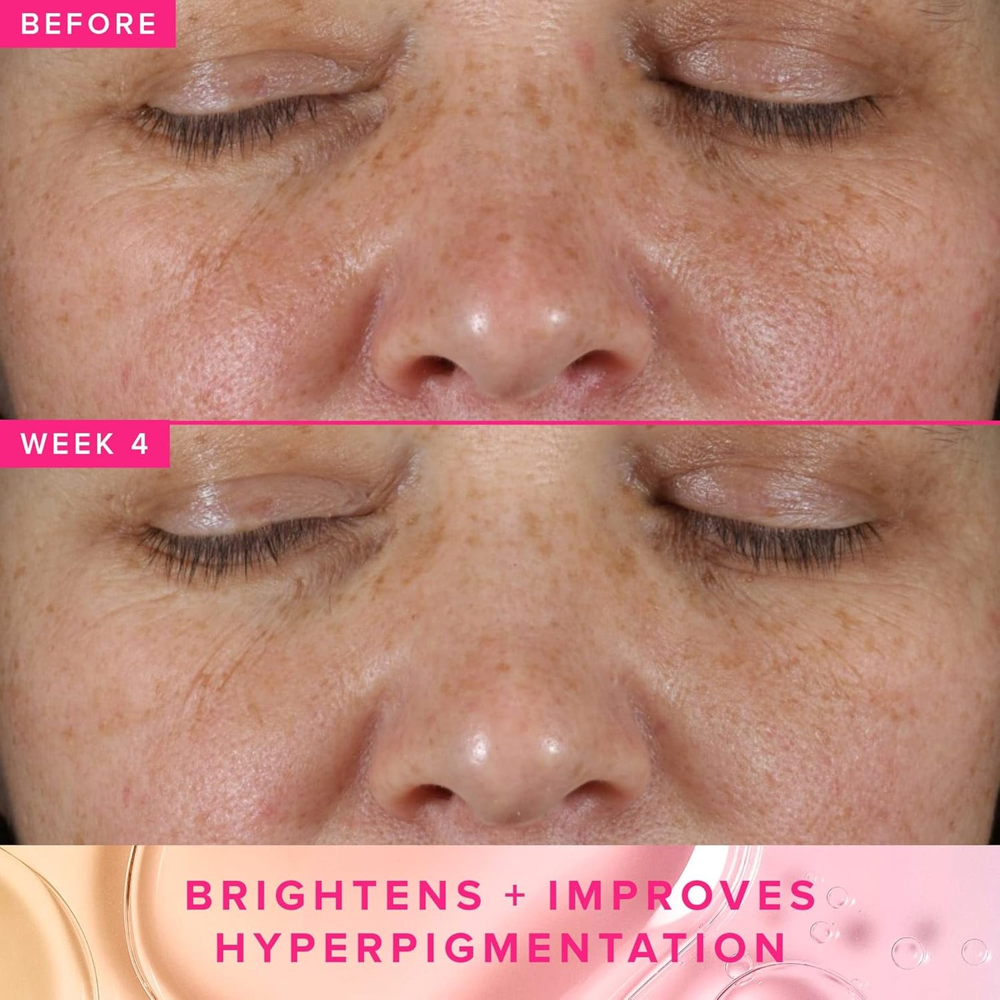 Farmacy 3% TXA Brightening Toner - Dark Spot Corrector with Azelaic Acid & Tranexamic Acid | 120ml