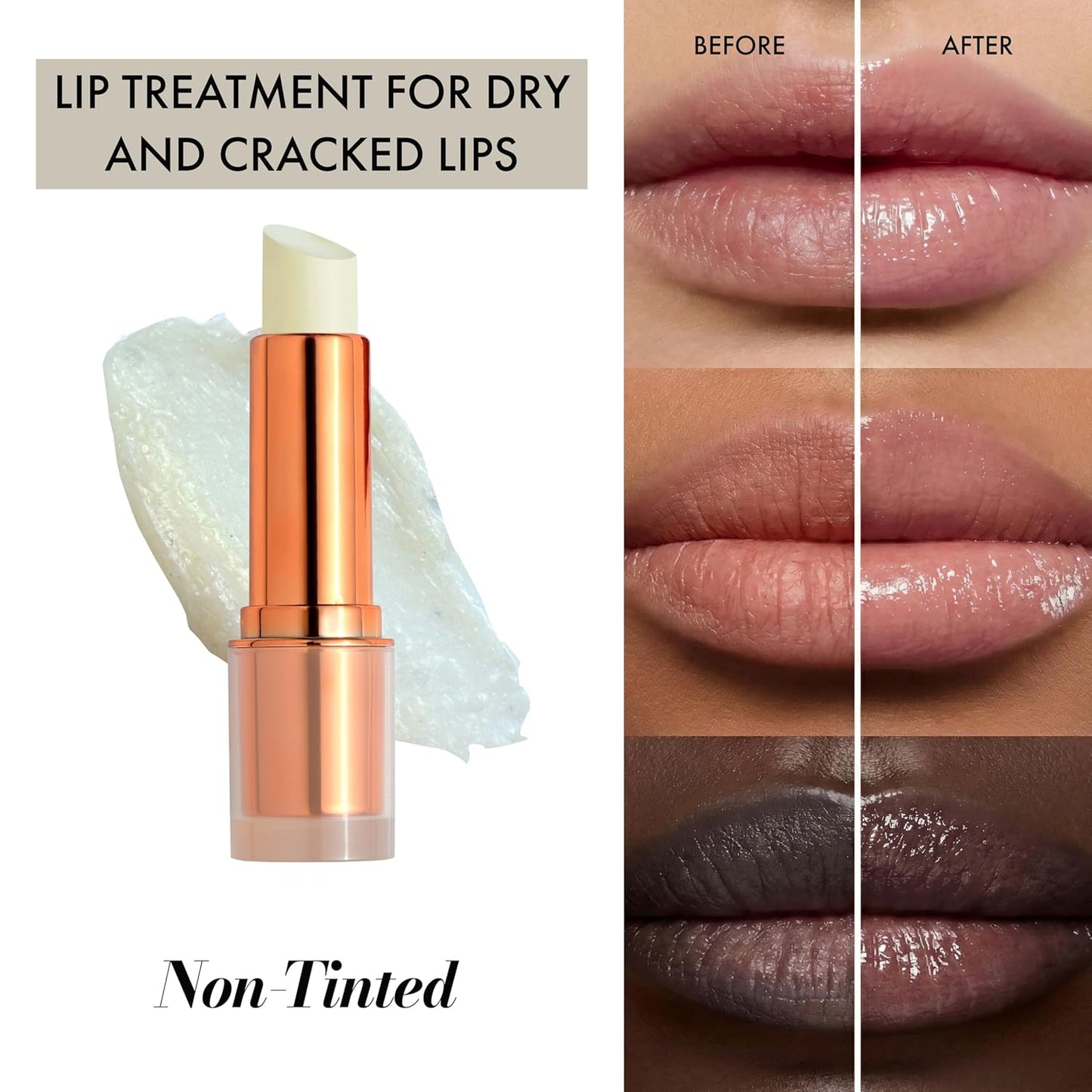 Skiennix Lip Balm - Hydrating Repair with Cold-Pressed Oils & 10% Squalane | Moisturizing Lip Butter for Dry Lips - Clean, Non-Toxic Care