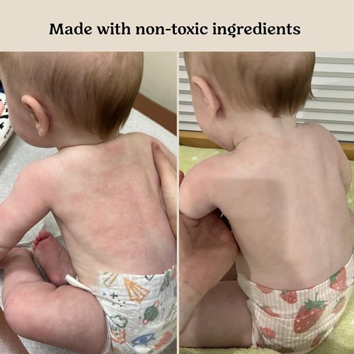 Roe Wellness Baby Cream & Serum Power Pair - Hydrating Skincare for All Ages | Ideal for Dry, Irritated Skin