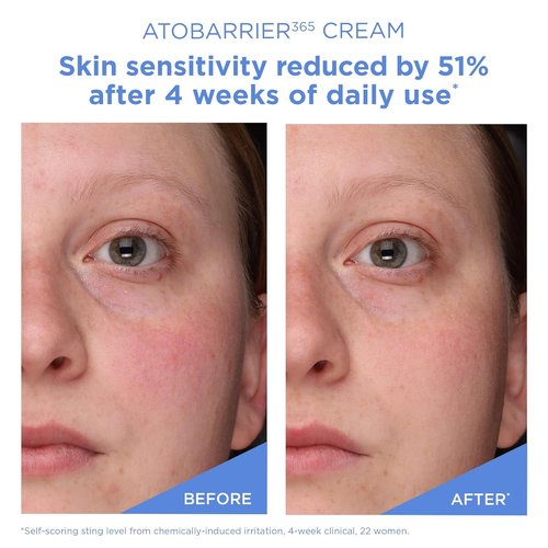 AESTURA ATOBARRIER365 Cream - Korean Face Moisturizer for Barrier Repair | 120H Hydration, 80 mL